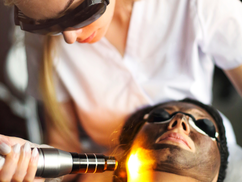 CO2 laser resurfacing