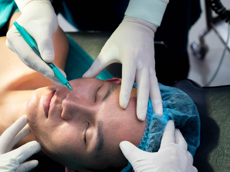 Facial Reconstruction after Mohs Surgery