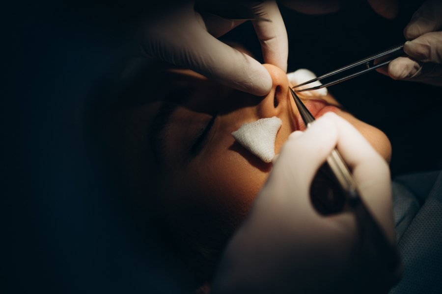 Rhinoplasty and Revision Rhinoplasty